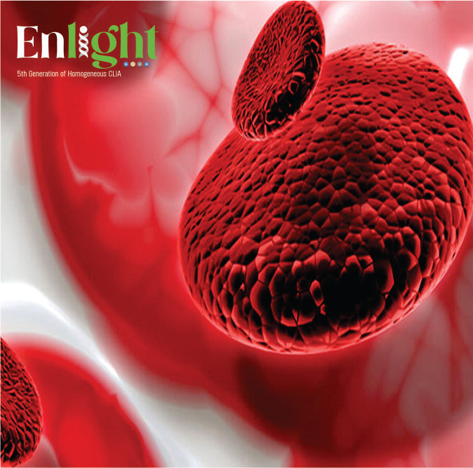 Anemia