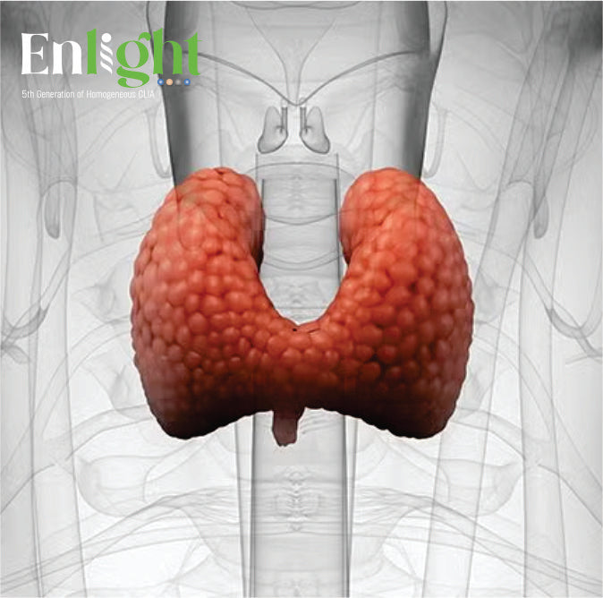 Thyroid