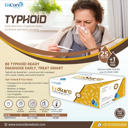 Typhoid IgG/IgM